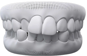 teeth-thumb01